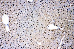 IHC analysis of ADK using anti- ADK antibody .