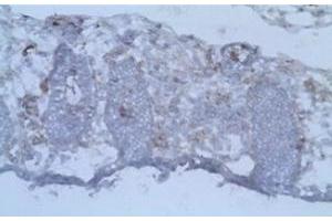Immunohistochemistry (IHC) image for anti-CD40 Ligand (CD40LG) antibody (ABIN1105904) (CD40 Ligand anticorps)