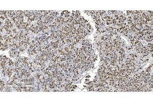IHC analysis of ARG2 using anti-ARG2 antibody (ABIN7602662).