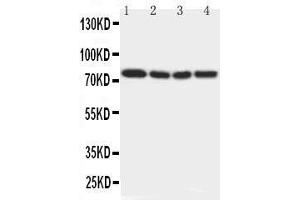 Anti-IRAK antibody, Western blotting Lane 1: Rat Liver Tissue Lysate Lane 2: Human Placenta Tissue Lysate Lane 3: MCF-7 Cell Lysate Lane 4: PANC Cell Lysate (IRAK1 anticorps  (N-Term))