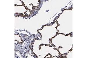 Immunohistochemical staining of human lung with MAGEB10 polyclonal antibody  shows strong cytoplasmic and membranous positivity in alveolar cells at 1:500-1:1000 dilution. (MAGEB10 anticorps)