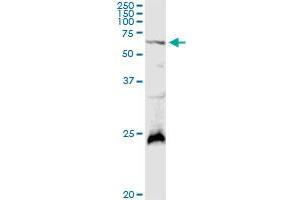 GALNT4 MaxPab rabbit polyclonal antibody. (GALNT4 anticorps  (AA 1-578))