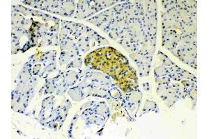 IHC analysis of IGFBP1 using anti-IGFBP1 antibody .