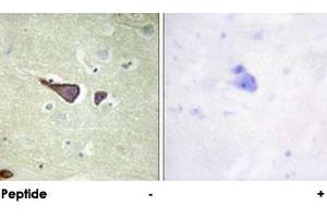 Immunohistochemical analysis of paraffin-embedded human brain tissue using IGF2R polyclonal antibody . (IGF2R anticorps)