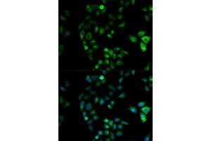 Immunofluorescence (IF) image for anti-Hydroxysteroid (17-Beta) Dehydrogenase 2 (HSD17B2) antibody (ABIN1873085) (HSD17B2 anticorps)