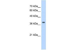 WB Suggested Anti-TPM1 Antibody Titration:  1. (Tropomyosin anticorps  (N-Term))