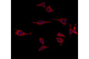 ABIN6264825 and ABIN6273015 staining HepG2 by IF/ICC.