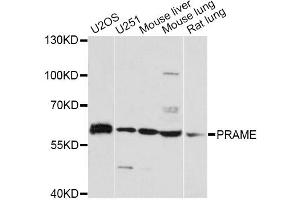 Western blot analysis of extracts of various cell lines, using PRAME antibody. (PRAME anticorps)