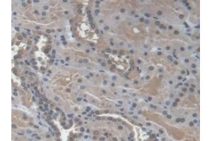 Detection of NME3 in Human Kidney Tissue using Polyclonal Antibody to Non Metastatic Cells 3, Protein NM23A Expressed In (NME3)