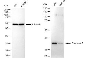 Western blotting analysis using caspase 6 antibody (ABIN7797900). (Recombinant Caspase 6 anticorps)