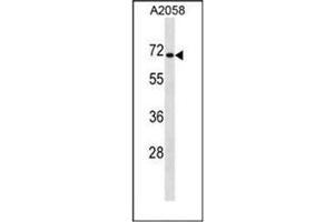 Western blot analysis of CPEB1 Antibody (C-term) in A2058 cell line lysates (35ug/lane). (CPEB1 anticorps  (C-Term))