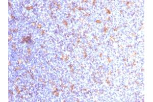 Formalin-fixed, paraffin-embedded human Tonsil stained with CD11c Mouse Monoclonal Antibody (ITGAX/1284). (CD11c anticorps  (AA 637-827))