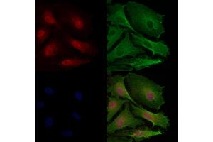 SGK1 Antibody staining A549 cells by IF/ICC. (SGK1 anticorps)