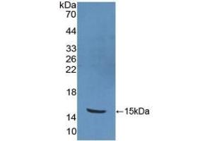 Detection of Recombinant PKIb, Human using Polyclonal Antibody to Protein Kinase Inhibitor Beta (PKIb) (PKIB anticorps  (AA 8-76))