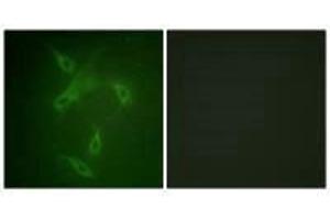 Immunofluorescence analysis of NIH/3T3 cells, using JAK2 (Ab-570) antibody.