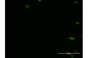 Immunofluorescence of monoclonal antibody to PTBP2 on HeLa cell. (PTBP2 anticorps  (AA 35-175))