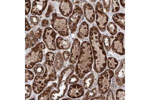 Immunohistochemical staining of human kidney with ZNF445 polyclonal antibody  shows strong granular cytoplasmic positivity in tubular cells. (ZNF445 anticorps)