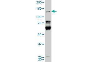 HIPK2 monoclonal antibody (M01), clone 4F4. (HIPK2 anticorps  (AA 961-1065))