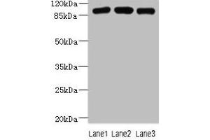 Western blot All lanes: ASAP3 antibody at 1 μg/mL Lane 1: A549 whole cell lysate Lane 2: MCF-7 whole cell lysate Lane 3: K562 whole cell lysate Secondary Goat polyclonal to rabbit IgG at 1/10000 dilution Predicted band size: 100, 44, 98 kDa Observed band size: 100 kDa