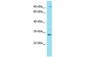 Host:  Rabbit  Target Name:  Nkx3-1  Sample Type:  Mouse Lung lysates  Antibody Dilution:  1. (NKX3-1 anticorps  (Middle Region))