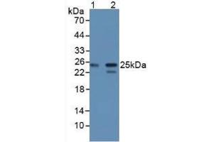 Figure. (CBFB anticorps  (AA 1-182))