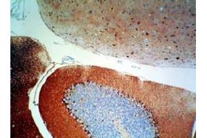 Image no. 1 for anti-S100 Calcium Binding Protein A1 (S100A1) antibody (ABIN401026)