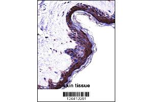 PSMB5 Antibody immunohistochemistry analysis in formalin fixed and paraffin embedded human skin tissue followed by peroxidase conjugation of the secondary antibody and DAB staining.