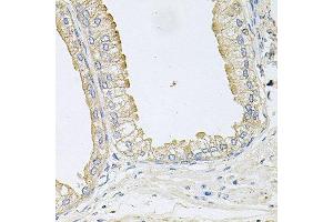 Immunohistochemistry of paraffin-embedded human prostate using ANKH antibody at dilution of 1:100 (x40 lens). (ANKH anticorps)