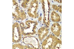 Immunohistochemistry of paraffin-embedded human kidney using RAB1B antibody.