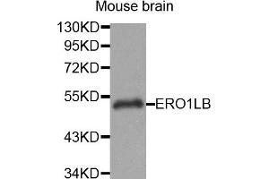 Western Blotting (WB) image for anti-ERO1-Like beta (ERO1LB) antibody (ABIN1875678) (ERO1LB anticorps)