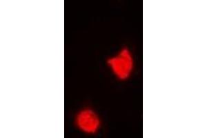 Immunofluorescent analysis of TREX1 staining in A549 cells.