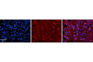 Rabbit Anti-RBP4 Antibody   Formalin Fixed Paraffin Embedded Tissue: Human Liver Tissue Observed Staining: Cytoplasm in Kupffer cells and sinusoids Primary Antibody Concentration: 1:100 Other Working Concentrations: 1:600 Secondary Antibody: Donkey anti-Rabbit-Cy3 Secondary Antibody Concentration: 1:200 Magnification: 20X Exposure Time: 0.