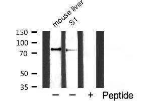 Western blot analysis of TIMP4 expression in NIH-3T3 whole cell lysates,The lane on the left is treated with the antigen-specific peptide. (IKK alpha anticorps  (pSer176, pSer177))