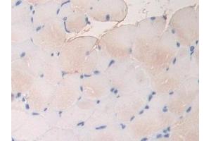 Detection of FBN1 in Mouse Skeletal muscle Tissue using Polyclonal Antibody to Fibrillin 1 (FBN1)