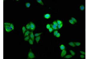Immunofluorescent analysis of HepG2 cells using ABIN7155253 at dilution of 1:100 and Alexa Fluor 488-congugated AffiniPure Goat Anti-Rabbit IgG(H+L)