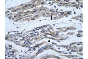 Image no. 2 for anti-Nuclear Factor of kappa Light Polypeptide Gene Enhancer in B-Cells 2 (NFKB2) (AA 711-758) antibody (ABIN6735824)