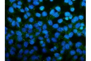 IF analysis of PAR-3/PARD3 using anti-PAR-3/PARD3 antibody (ABIN7598983).