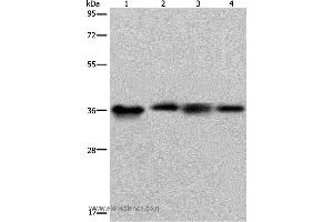 Western blot analysis of HepG2 and 293T cell, human kidney cancer tissue and K562 cell, using F11R Polyclonal Antibody at dilution of 1:500 (F11R anticorps)