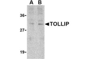 Image no. 1 for anti-Toll Interacting Protein (TOLLIP) (C-Term) antibody (ABIN265153) (TOLLIP anticorps  (C-Term))