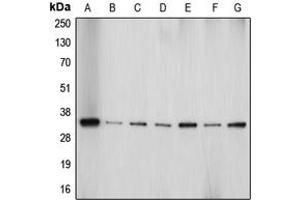 Western blot analysis of Aquaporin 4 expression in HeLa (A), Jurkat (B), PC12 (C), SP2/0 (D), HepG2 (E), U87MG (F), mouse brain (G) whole cell lysates. (Aquaporin 4 anticorps  (Center))