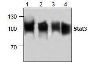 AP26348PU-N: Western blot analysis of Stat3 in lysate from Jurkat cells (Lane 1 & 2), 3T3 cells (Lane 3) and rat kidney (Lane 4). (STAT3 anticorps)