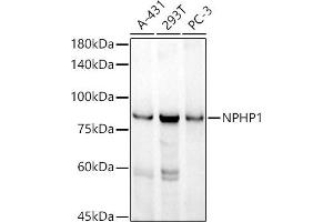 Western blot analysis of extracts of various cell lines, using NPHP1 antibody (ABIN7268847) at 1:1000 dilution.