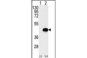 Western blot analysis of BCKDK (arrow) using rabbit polyclonal BCKDK Antibody (Center) (ABIN391176 and ABIN2841276). (BCKDK anticorps  (AA 120-151))