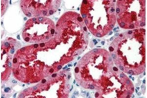 Human Kidney (formalin-fixed, paraffin-embedded) stained with EN2 antibody ABIN462164 followed by biotinylated goat anti-rabbit IgG secondary antibody ABIN481713, alkaline phosphatase-streptavidin and chromogen.