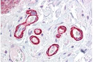 Anti-SLC39A14 antibody IHC staining of human colon, vessels. (SLC39A14 anticorps  (Internal Region))