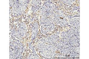 IHC analysis of MT-ND5 using anti-MT-ND5 antibody (ABIN7600145). (MT-ND5 anticorps  (AA 154-570))