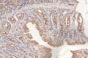 Immunohistochemistry analysis of paraffin-embedded rat colon using,PFDN4 (ABIN7075171) at dilution of 1: 4200