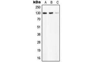 Western blot analysis of PLC beta 2 expression in HeLa (A), SP2/0 (B), H9C2 (C) whole cell lysates. (Phospholipase C beta 2 anticorps  (Center))