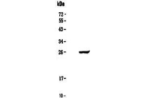 Western blot analysis of Serum Amyloid P using anti-Serum Amyloid P antibody . (APCS anticorps  (AA 20-220))
