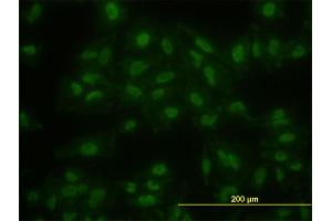 Immunofluorescence of monoclonal antibody to KLF11 on HeLa cell.